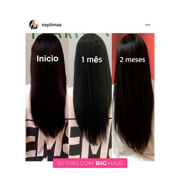 Antes e depois 2